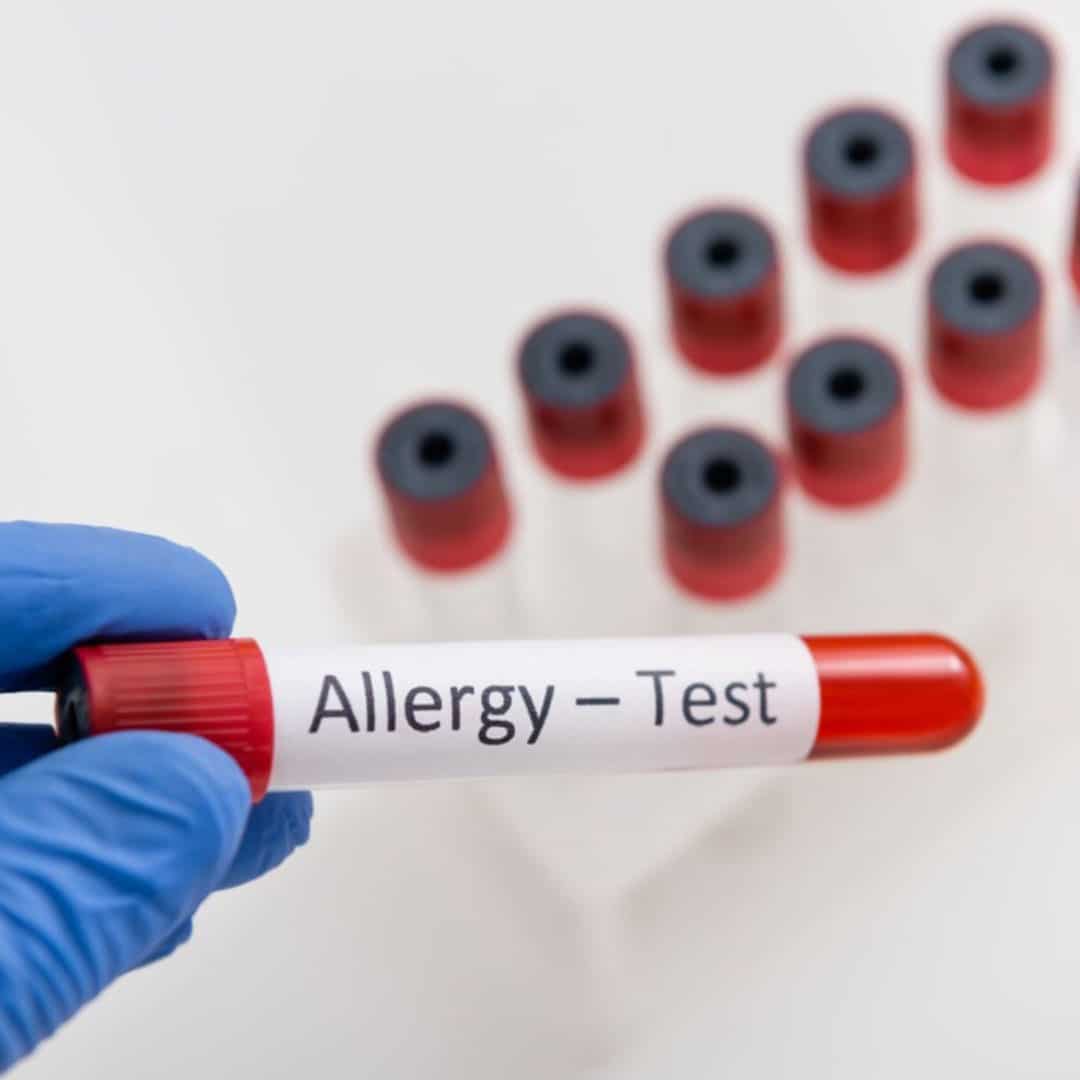 San-Antonio-Breath-Free-Allergy-Testing-001 San Antonio Breathe Free Allergy Testing Blood Work