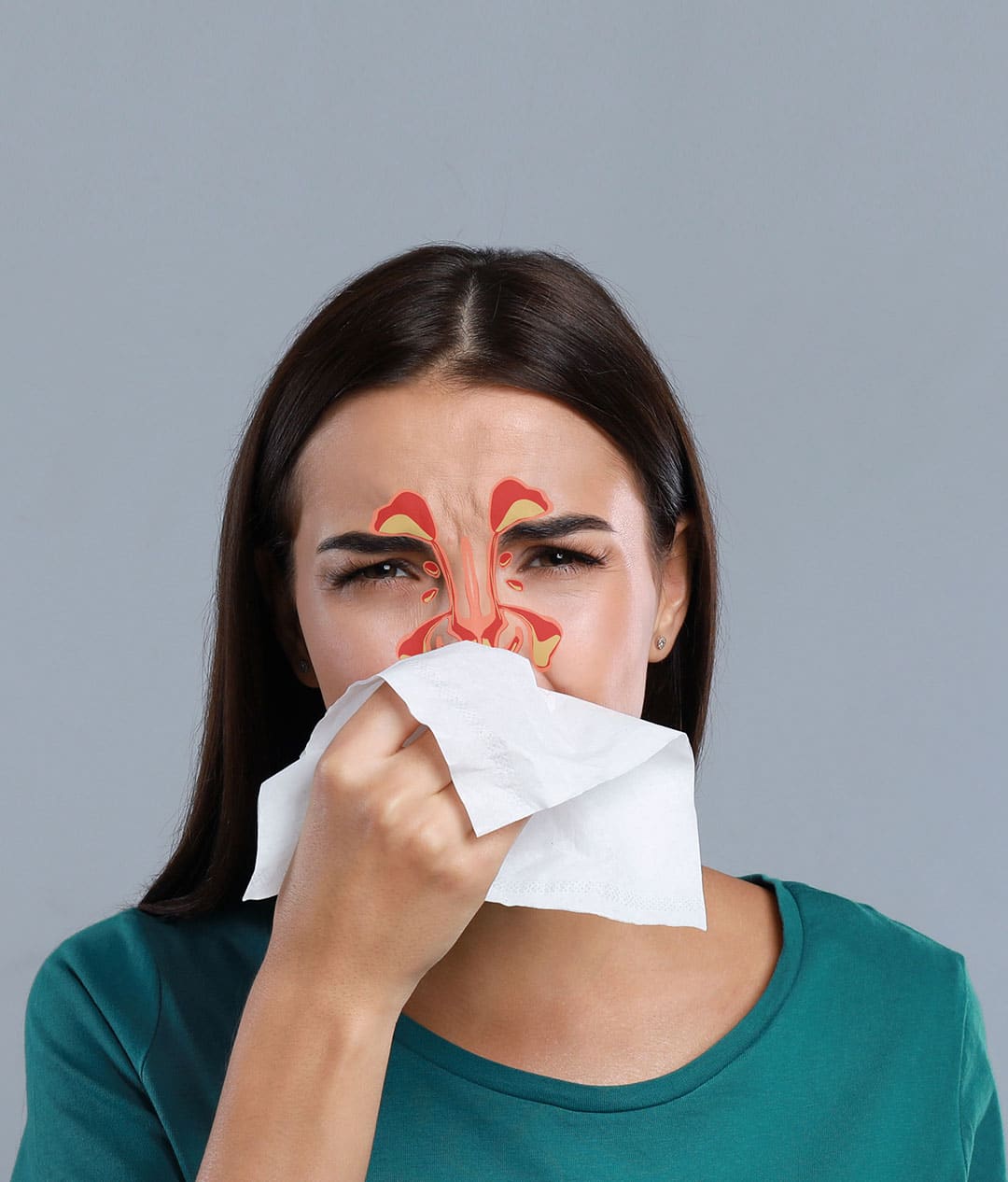 San Antonio Breathe Free Ballon Sinuplasty Treatment