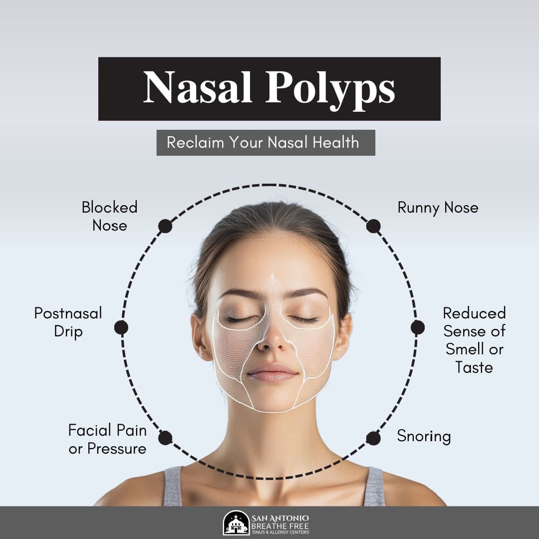 San-Antonio-Breath-Free-Nasal-Polyps-001 San Antonio Breathe Free Nasal Polyps Symptoms